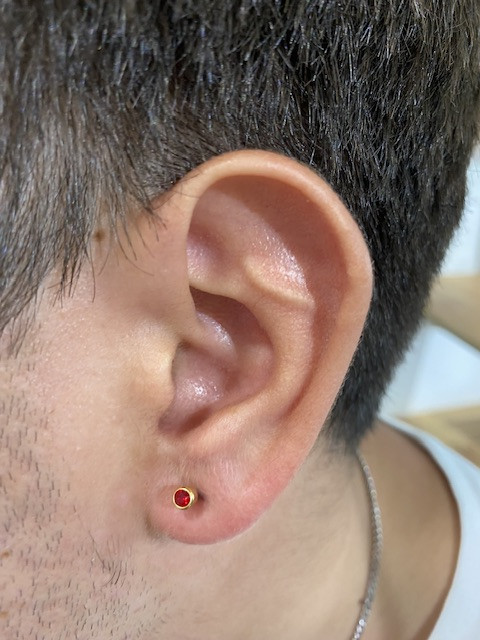 Lobe