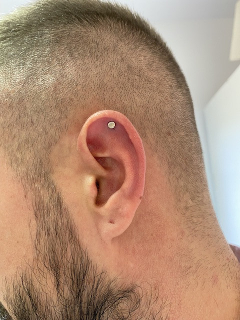Helix