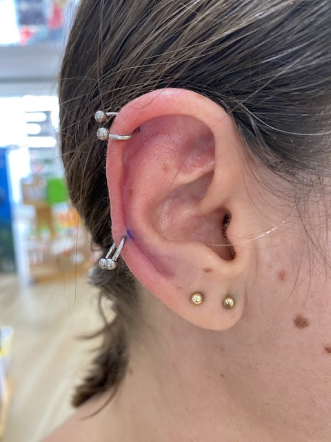 Helix y mid helix