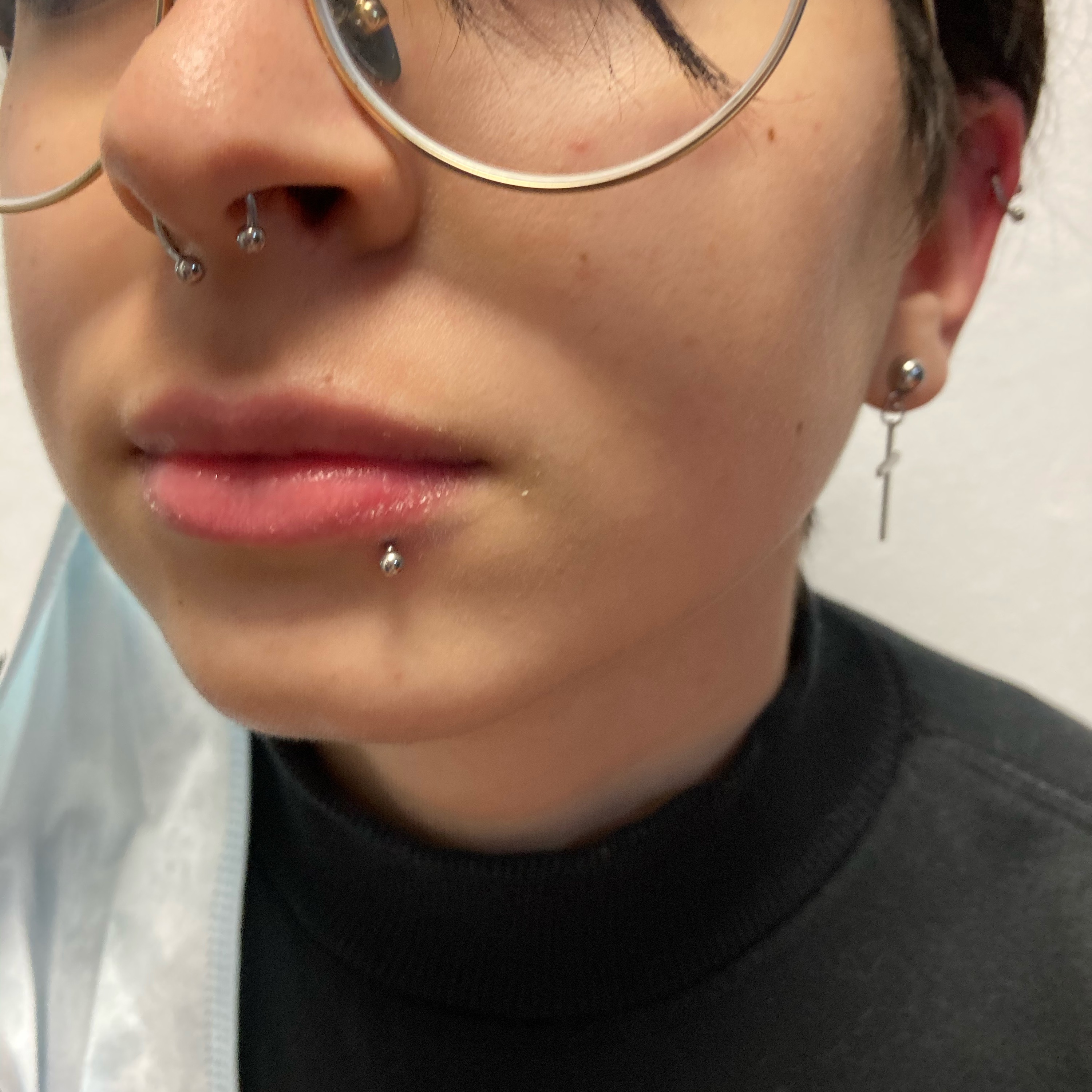 LABRET LATERAL